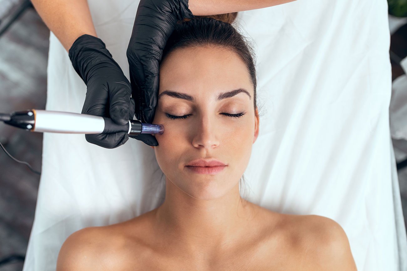 women taking Fractora RF Microneedling